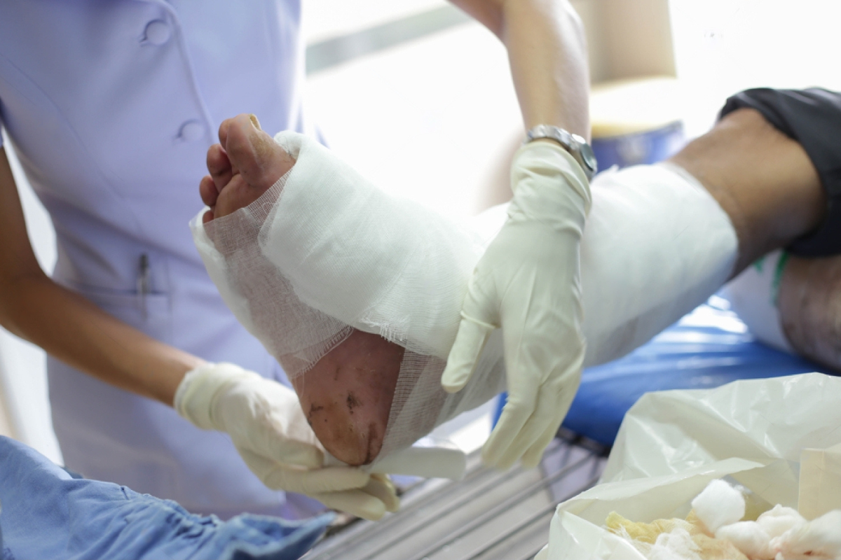 Orthopedic Treatment for Infected Wounds Expert Care for Faster Healing and Recovery